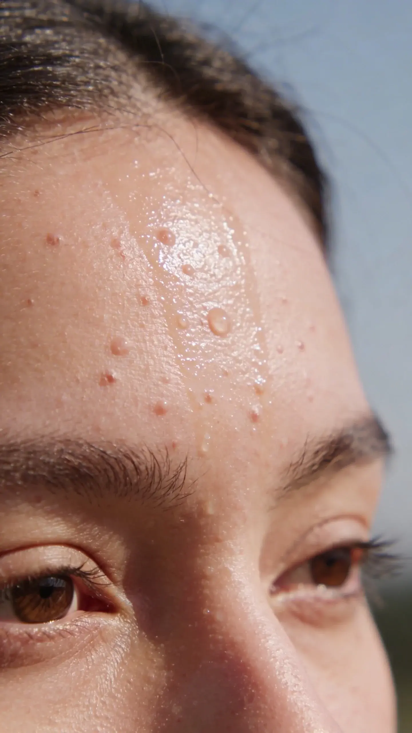 Close-up oily T-zone with visible clogged pores, daylight